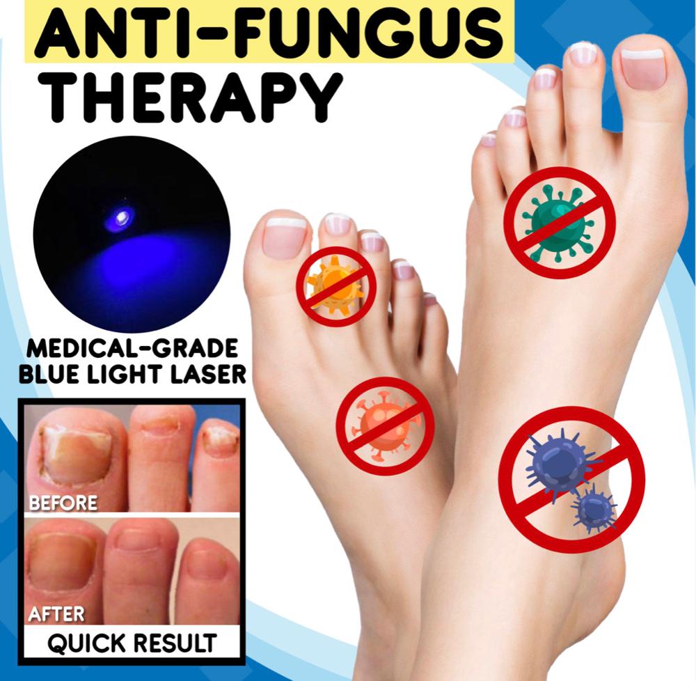 Nail Fungus Home Treatment Set